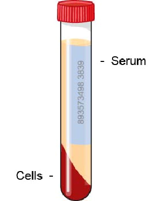 serum_protein_electrophoresis-1